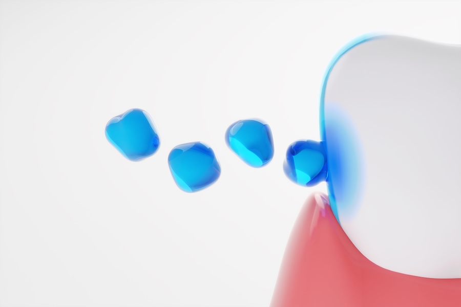 image of fluoride from fluoride treatment or toothpaste on tooth