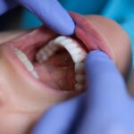 oral cancer screening