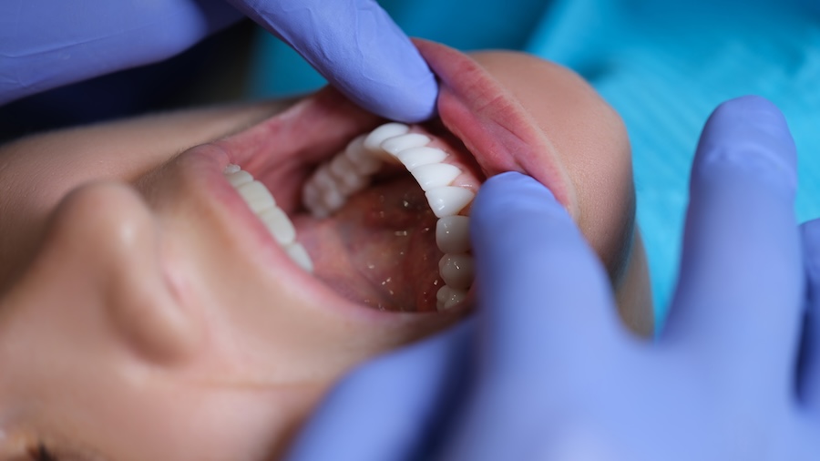 oral cancer screening